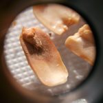 Moldy peanuts viewed through a microscope