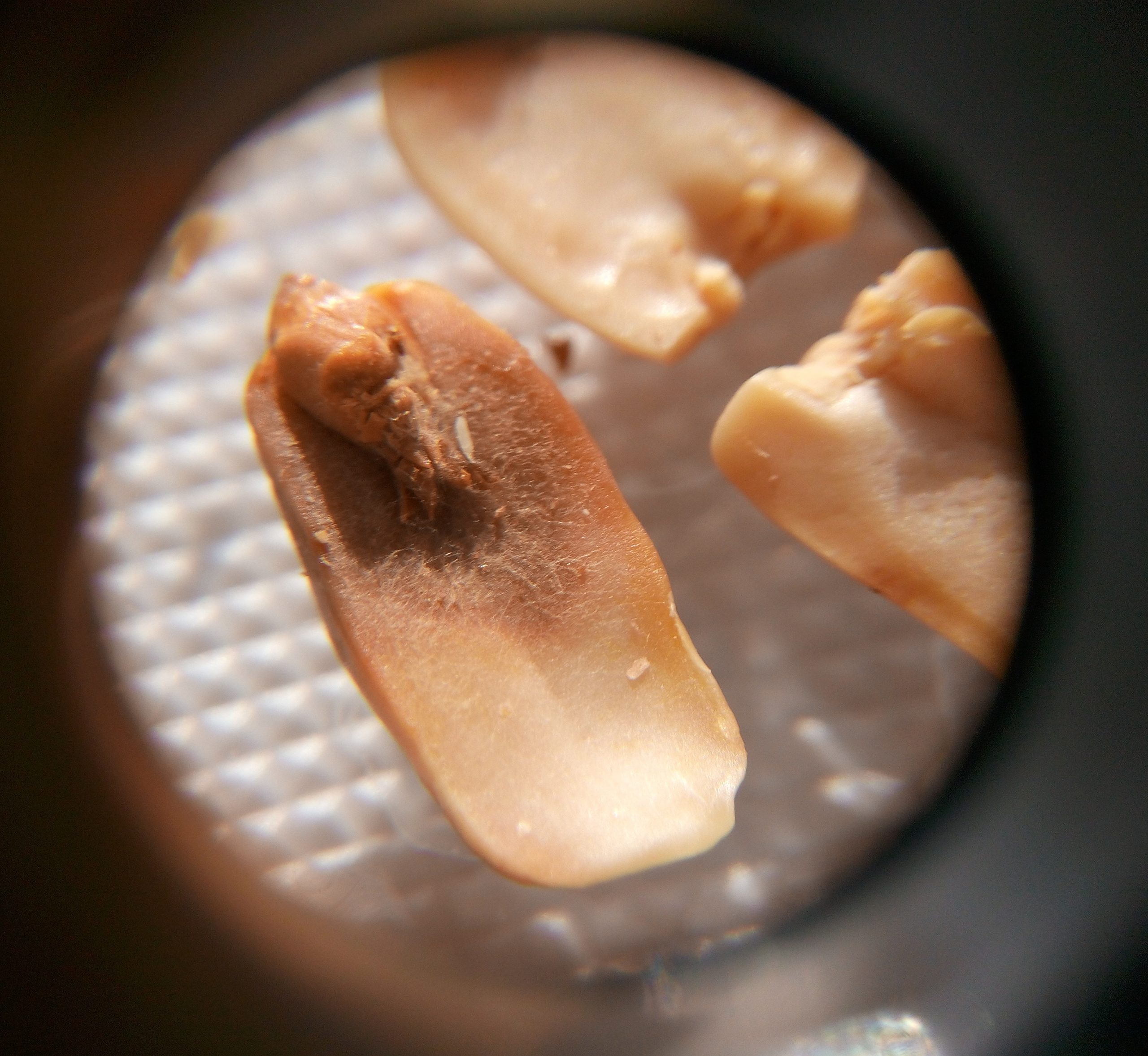 Moldy peanuts viewed through a microscope